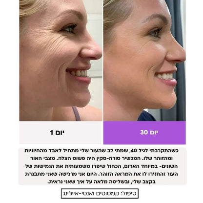 Sora Skin – מכשיר אנטי-אייג'ינג להרמה, מיצוק וחידוש העור