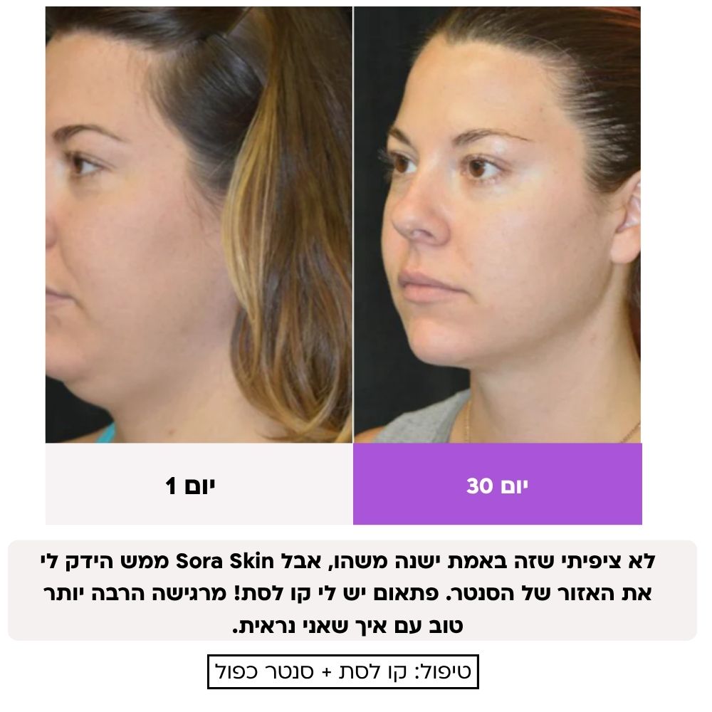 Sora Skin – מכשיר אנטי-אייג'ינג להרמה, מיצוק וחידוש העור